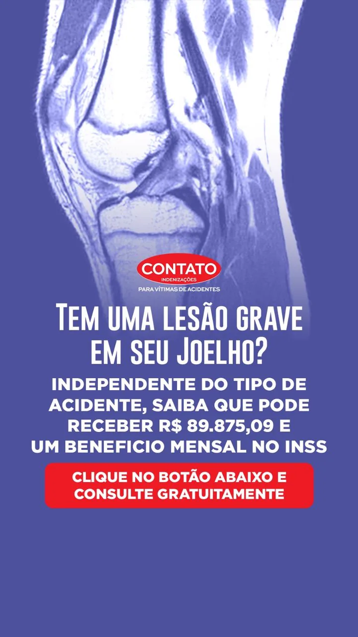 Anúncio da Contato Indenizações sobre lesão no joelho